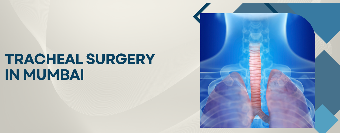 Tracheal Surgery Banner