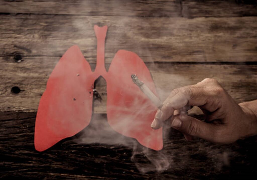 Effect of Smoking on the Lungs: Understanding the consequences