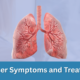 Lung Cancer Symptoms and Treatment Plan | George thoracic Lung Cancer Symptoms and Treatment Plan
