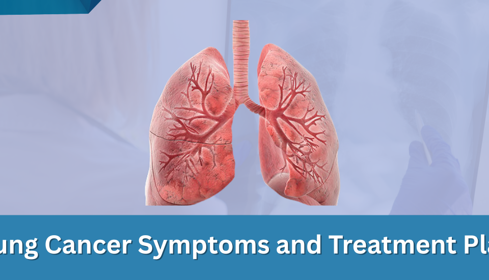 Lung Cancer Symptoms and Treatment Plan | George thoracic Lung Cancer Symptoms and Treatment Plan