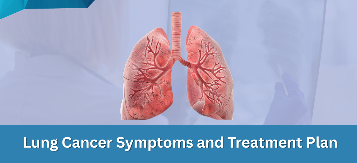 Lung Cancer Symptoms and Treatment Plan