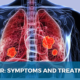 Lung_Cancer_Symptoms_and_Treatment_Plan_