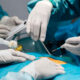 What are Mediastinal Tumor Symptoms and is Surgery Needed