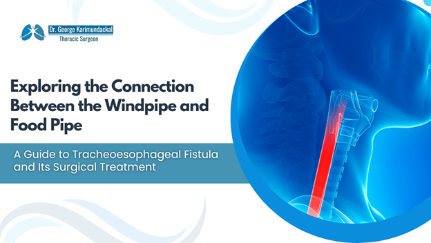 Cover image for a medical guide: 'Exploring the Connection Between the Windpipe and Food Pipe' with subtitle 'A Guide to Tracheoesophageal Fistula and Its Surgical Treatment'; features a blue circular medical illustration of the airway and esophagus.