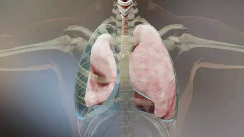 Anatomical illustration of the human thorax showing the lungs, trachea, and surrounding rib cage.