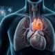 What Is a Thymoma and Does It Need Surgery