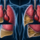 Empyema vs Pleural Effusion What's the Difference | George thoracic Empyema vs Pleural Effusion What's the Difference