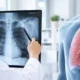 What Is a Pancoast Tumor and How Is It Treated | George thoracic What Is a Pancoast Tumor and How Is It Treated