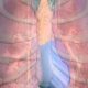 Medical illustration of a human chest with a transparent rib cage highlighting the lungs and heart.