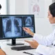 Recurrent Pneumothorax When Is Surgery Needed | George thoracic Recurrent Pneumothorax When Is Surgery Needed