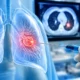 Lung Nodule Biopsy- When Is It Needed and What to Expect | George thoracic Guided lung tumor ablation: a medical probe targets a red-highlighted tumor inside the left lung, with a clinician and monitor in the background.